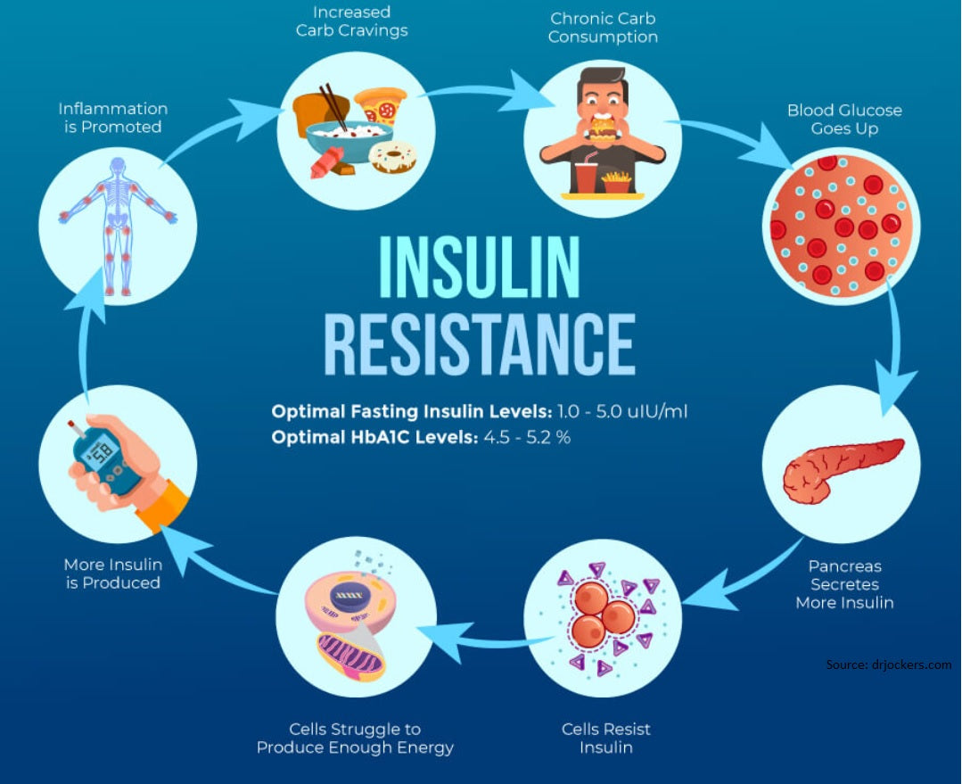 Insulin Resistance and Diabetes: Are they related?